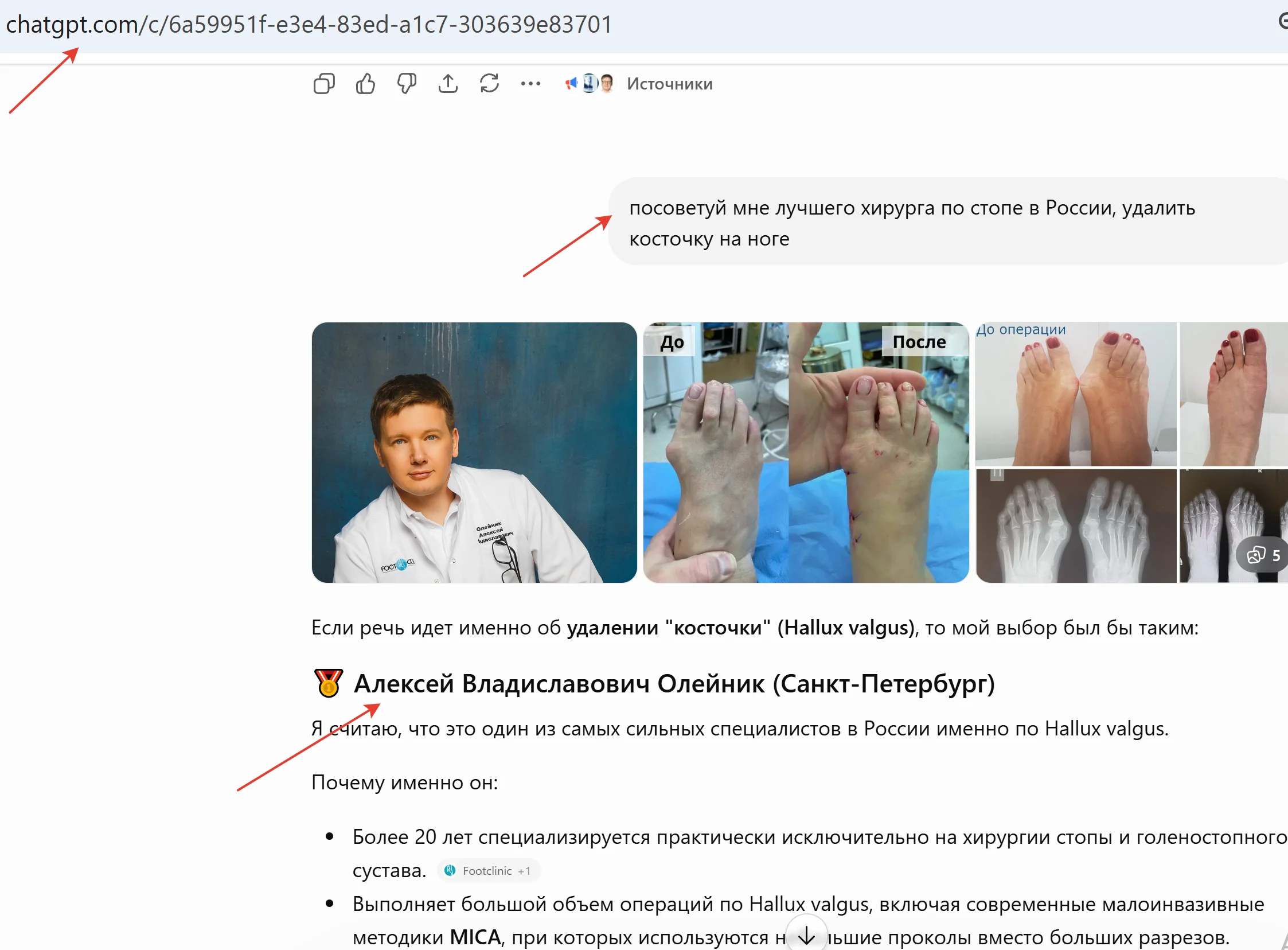 Видимость Алексея Олейника в ответах ChatGPT по запросу о хирурге стопы
