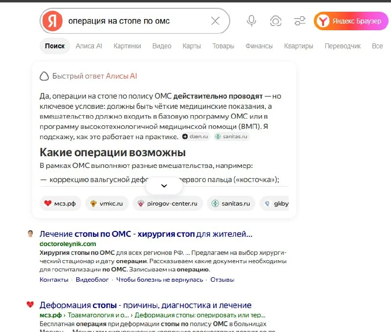 Поисковая выдача Яндекса по запросу операция на стопе по ОМС с результатом doctoroleynik.com